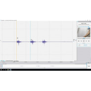 Synchronisation video - Module Logiciel OpenSignals | Mtraining