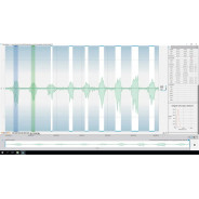 EMG - module logiciel OpenSignals | Mtraining