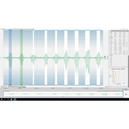 EMG - module logiciel OpenSignals | Mtraining