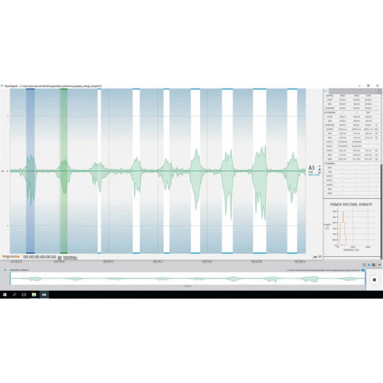 EMG - module logiciel OpenSignals | Mtraining