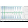 EMG - module logiciel OpenSignals | Mtraining