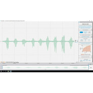 Charge musculaire - module d analyse OpenSignals | Mtraining