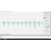 Charge musculaire - module d analyse OpenSignals | Mtraining
